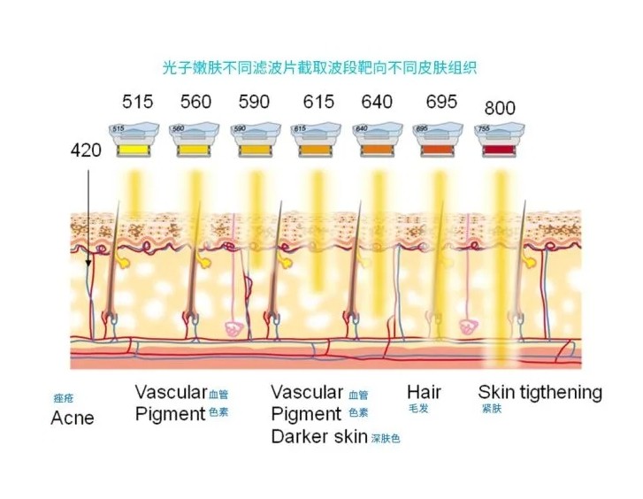 五大光子嫩膚技術(shù)（IPL、DPL、OPT、APT、BBL）及濾光片區(qū)別